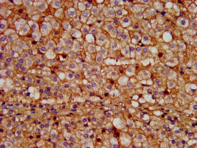 Polyclonal Rabbit anti-Human PROK1 / EG-VEGF Antibody (IHC)