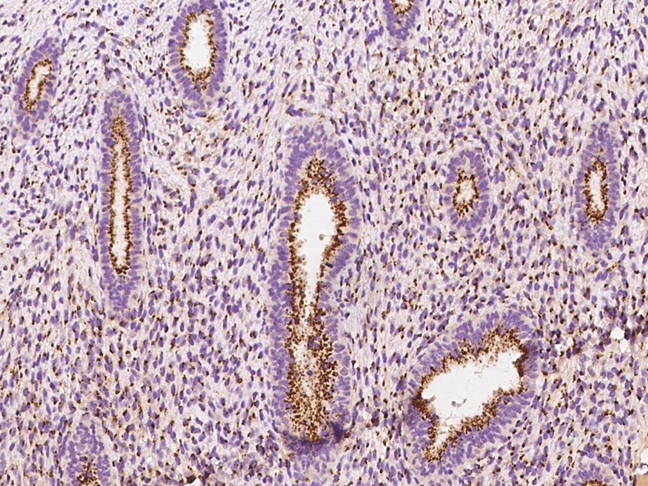 YIPF4 Antibody