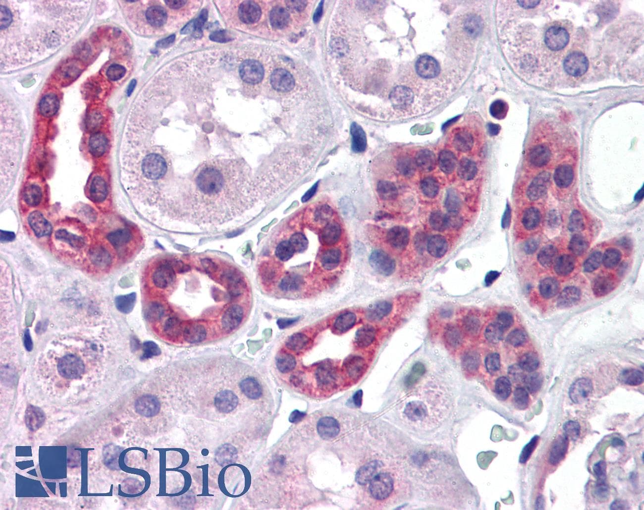 IHC-plus™ Polyclonal Goat anti-Human SUPT16H / FACTP140 Antibody (aa385-397, IHC, WB)