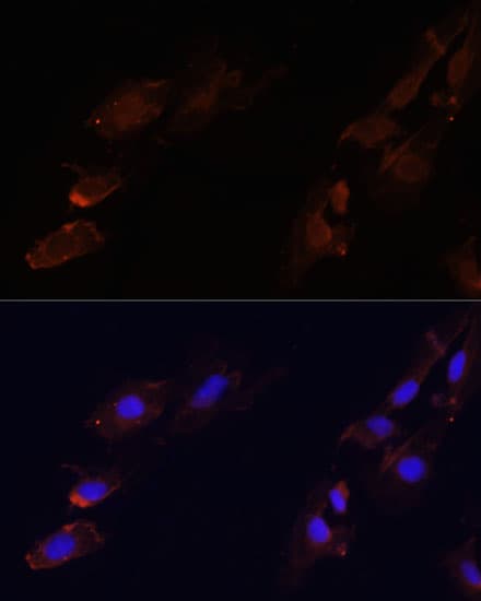 CTGF Antibody