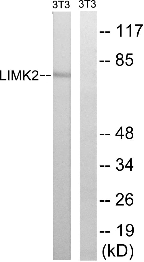 Polyclonal Rabbit anti-Human LIMK2 Antibody (aa249-298, IHC, WB)