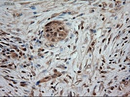 Monoclonal Mouse anti-Human NTF3 / Neurotrophin 3 Antibody (clone OTI5A2, IHC, IF, WB)
