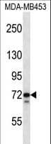TMPO / TP / Thymopoietin Antibody (aa166-195)