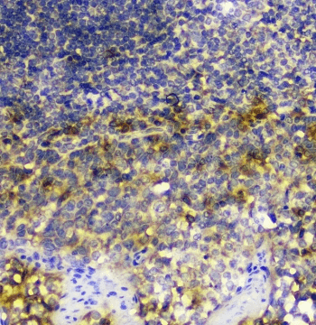 Polyclonal Rabbit anti-Human SIRT4 / Sirtuin 4 Antibody (IHC, WB)
