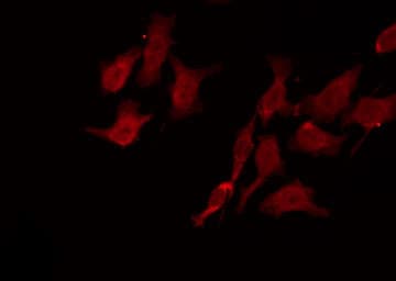 RP49 / CNG1 Antibody