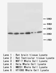 IHC-plus™ SCN1B Antibody (N-Terminus)