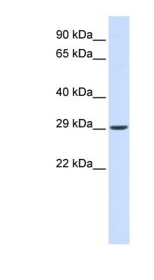 VTI1A Antibody (N-Terminus)