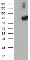 Alpha-Fetoprotein Antibody (clone OTI2H7)