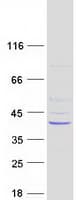 Human THOC6 Protein (Recombinant Myc-DDK (Flag))