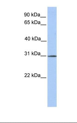 SURF4 Antibody (N-Terminus)