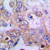 GNRH2 Antibody