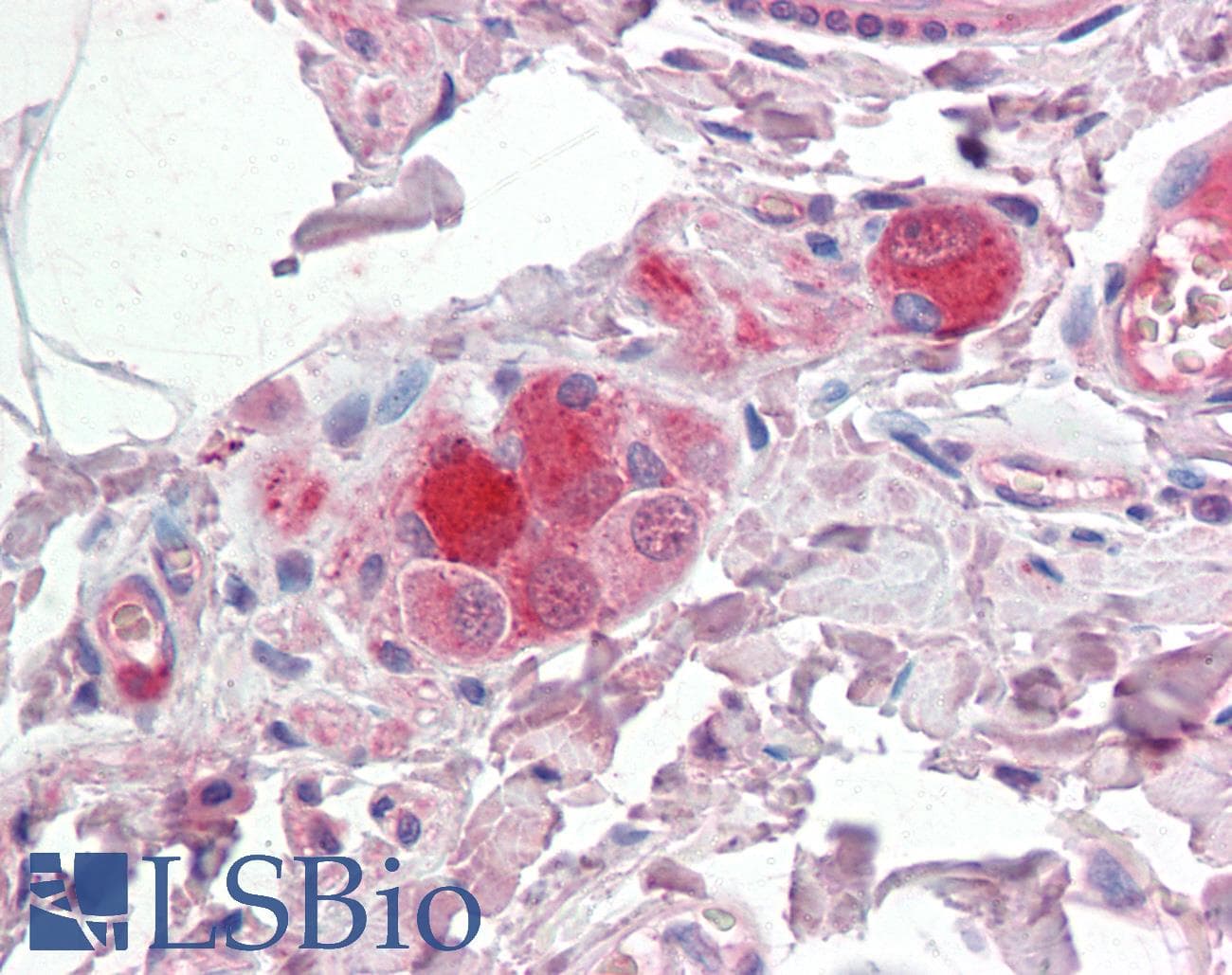 IHC-plus™ Polyclonal Rabbit anti-Human TAC1 Antibody (IHC)