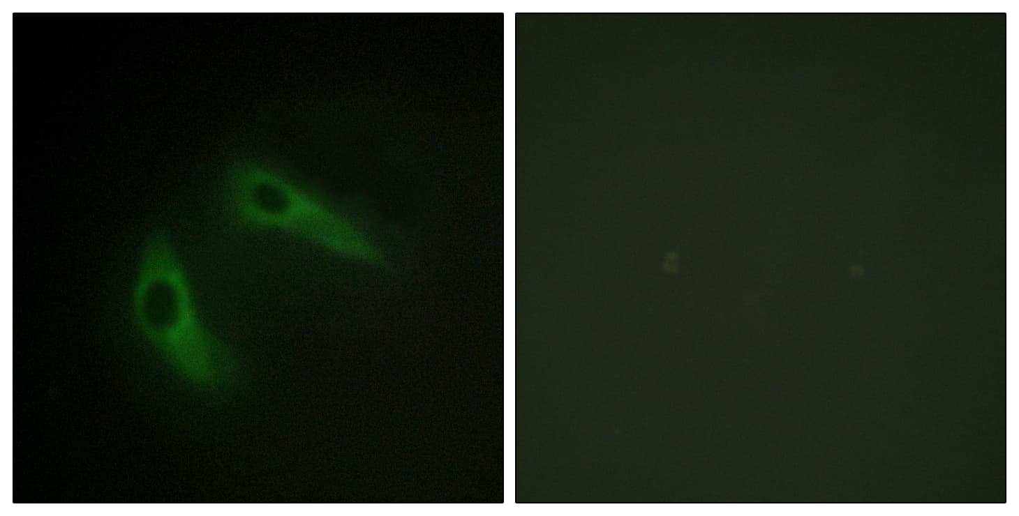 KCNIP1 / KCHIP1 Antibody (aa1-50)