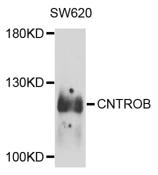 Polyclonal Rabbit anti-Human CNTROB Antibody (WB)