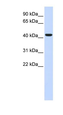 PathPlus™ BACE1 / BACE Antibody (aa72-121)