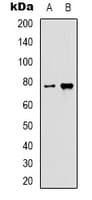 HSPA5 / GRP78 / BiP Antibody
