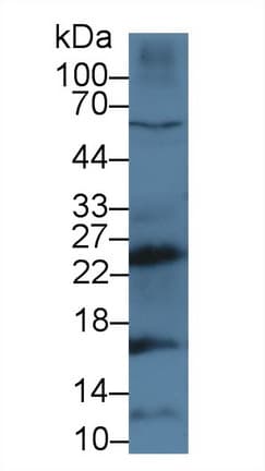 CTSG / Cathepsin G Antibody (aa21-261, PE)