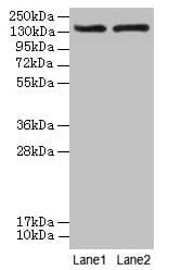 ABCB1 / MDR1 / P Glycoprotein Antibody