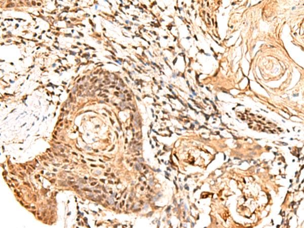FAM134B Antibody