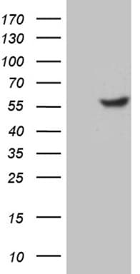 TFDP2 / DP2 Antibody (clone OTI4C11)