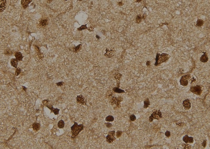 TCTN3 Antibody