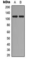 TOP3A Antibody (Internal)