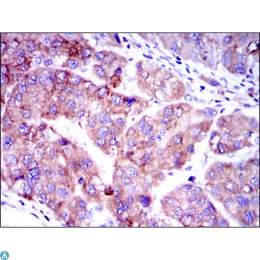 SMAD2 Antibody