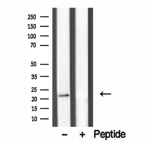 Dermatopontin / DPT Antibody