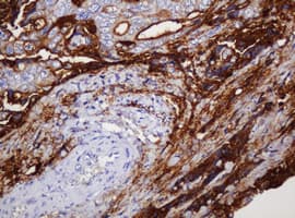 EMA / MUC1 Antibody (clone OTI3A7)