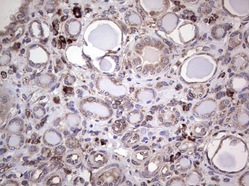 MTDH / Metadherin Antibody (aa70-582, clone OTI1H1)