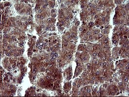 MAP2K1 / MKK1 / MEK1 Antibody (clone OTI5D3)
