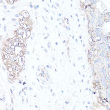 Polyclonal Rabbit anti-Human MAP1LC3B / LC3B Antibody (IHC, IF, WB)
