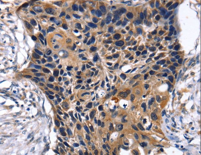 SLC2A2 / GLUT2 Antibody