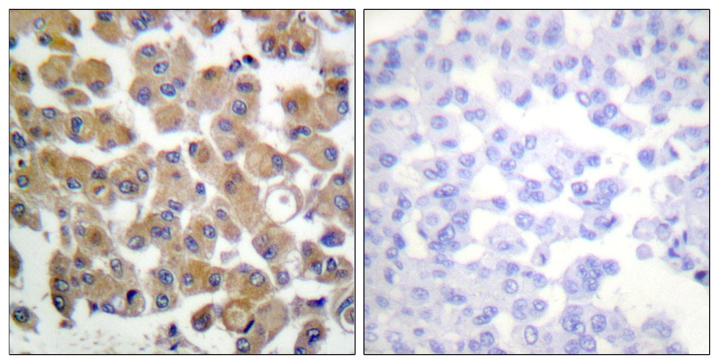 Polyclonal Rabbit anti-Human TGFB1 / TGF Beta 1 Antibody (IHC, WB)