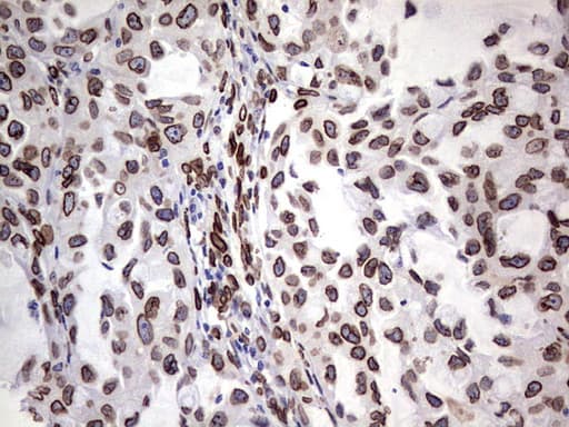 BCL6 Antibody (aa1-300, clone OTI1C3, Carrier-free)