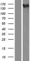 AATK / AATYK Protein (Over-Expression Lysate Myc-DDK (Flag))