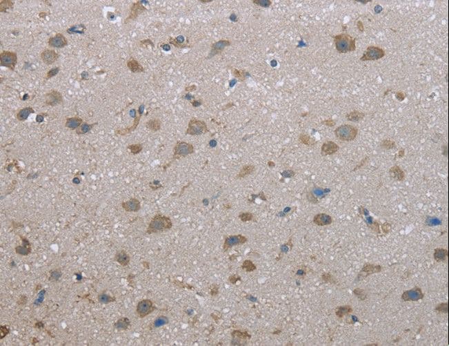 FAP Alpha Antibody