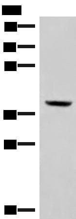 Polyclonal Rabbit anti-Human PEG1 / MEST Antibody (IHC, WB)