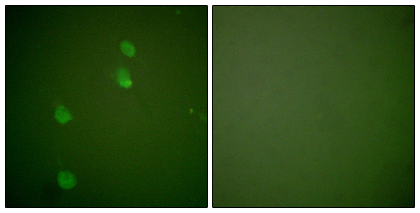 IHC-plus™ CUL2 / Cullin 2 Antibody (aa696-745)