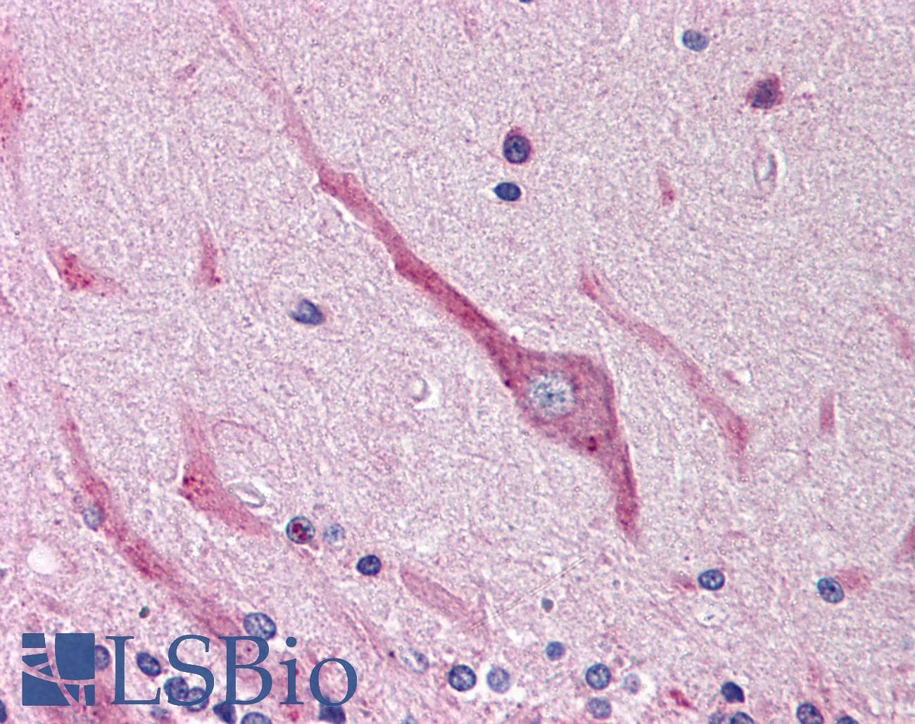 IHC-plus™ SNAI2 / SLUG Antibody