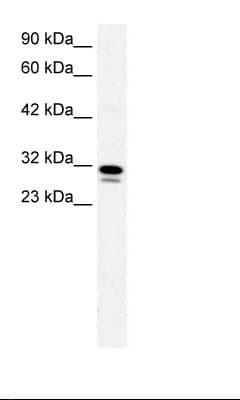 SSBP2 Antibody (aa131-180)