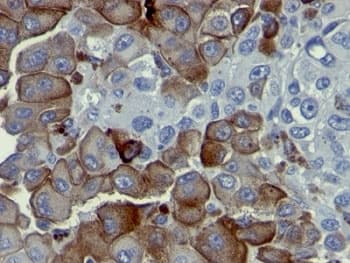 NGFR / CD271 / TNR16 Antibody (clone NGFR5)