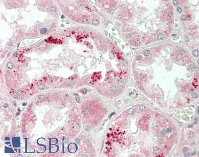 IHC-plus™ APOA1 / Apolipoprotein A 1 Antibody (aa75-87)