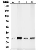 CDX2 Antibody (Internal)