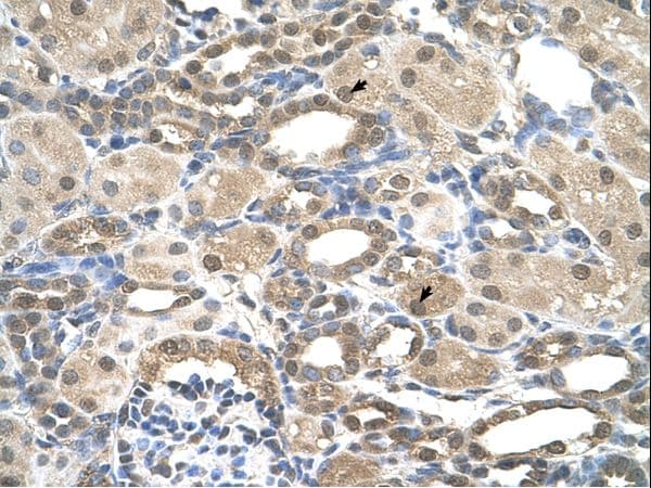 PSEN2 / Presenilin 2 Antibody (aa101-150)