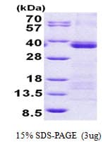 Human U2AF1 Protein (Recombinant His)