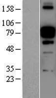 POSTN / Periostin Protein (Over-Expression Lysate Myc-DDK (Flag))