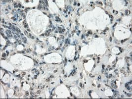FRA-1 / FOSL1 Antibody (clone OTI12F9)