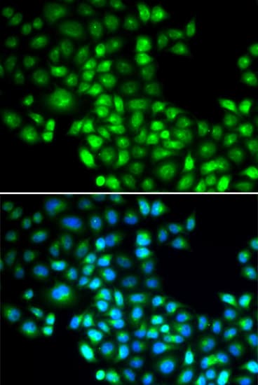 FOXP1 Antibody