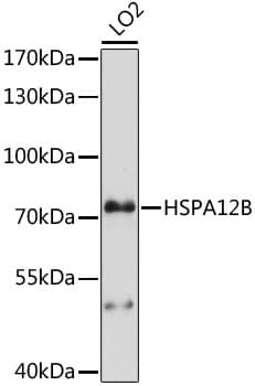 Polyclonal Rabbit anti-Human HSPA12B Antibody (WB)